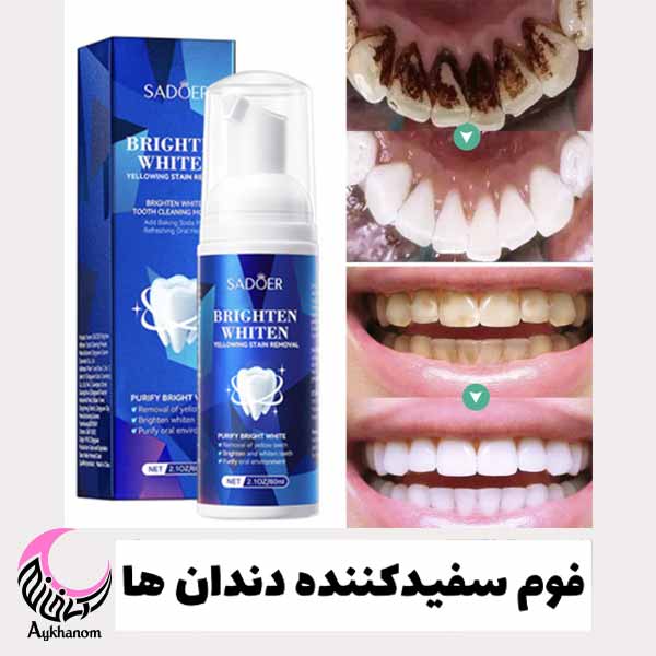 فوم سفید کننده و رفع زردی دندان سادور-رفع زردی دندان-سفید کننده دندان-خوشبو کننده دهان-محافظت از مینای دندان
