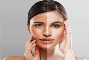 سرم ویتامین سی؛ جادوی روشن‌کننده فروشگاه اینترنتی آی خانمی